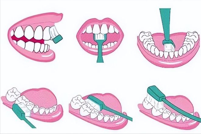 牙结石没了！过来人分享3个自用小妙招！(图4)
