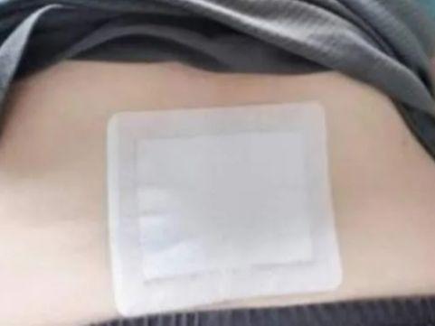 多年腰突难彩神恢复怎么办？学会这三个小妙招1个月恢复不是梦！(图3)